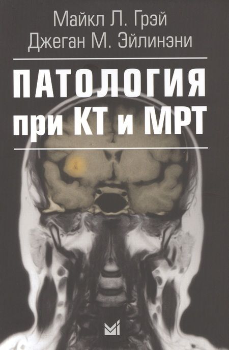 Фотография книги "Джон Грэй: Патология при КТ и МРТ"