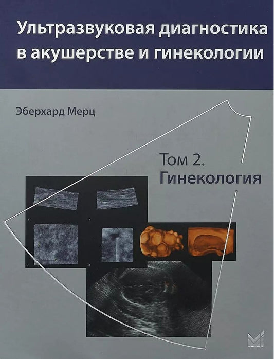 Обложка книги "Эберхард Мерц: Ультразвуковая диагностика в акушерстве и гинекологии. Т.2."