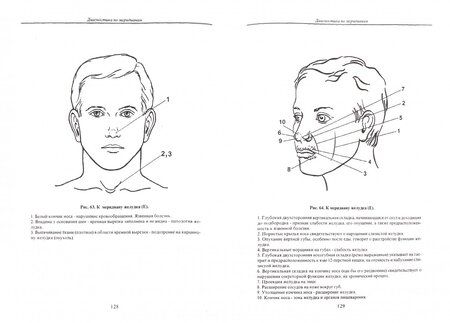 Фотография книги "Эмма Гоникман: Искусство диагностики по лицу. Атлас"