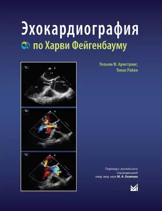 Обложка книги "Ф., Райан: Эхокардиография по Харви Фейгенбауму"