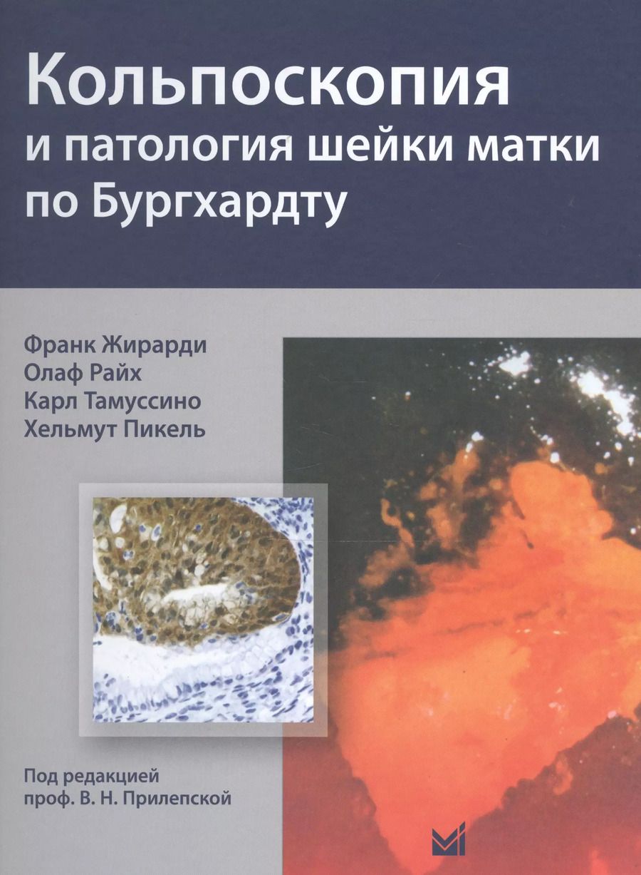 Обложка книги "Франк Жирарди: Кольпоскопия и патология шейки матки по Бургхардту"