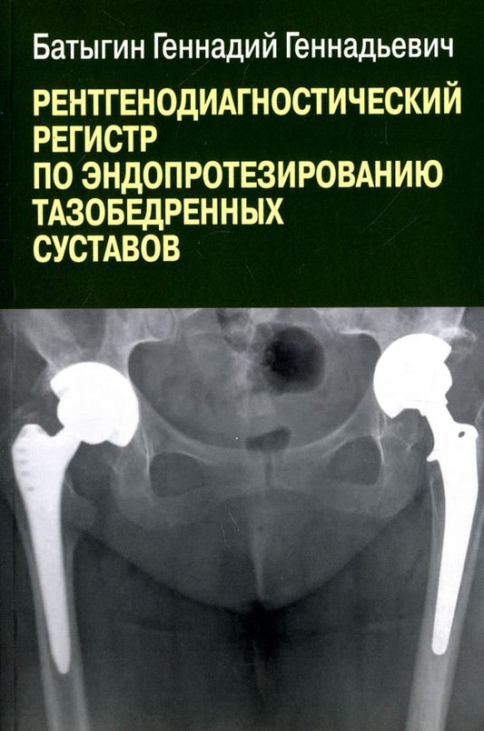 Обложка книги "Геннадий Батыгин: Рентгенологический регистр по эндопротезированию тазобедренных суставов"