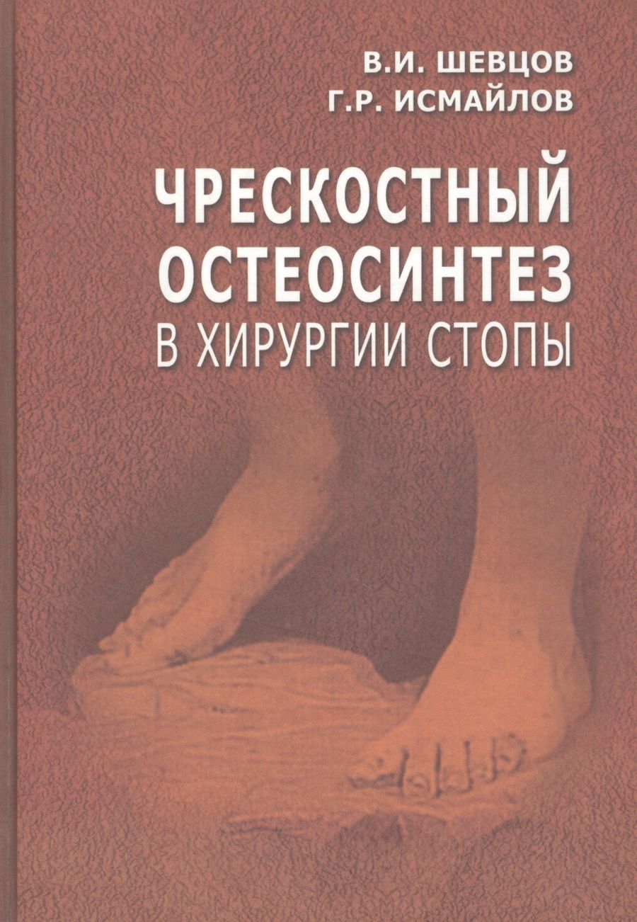 Обложка книги "Георгий Шевцов: Чрескостный остеосинтез в хирургии стопы. Руководство для врачей"