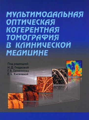 Обложка книги "Гладкова, Геликонов, Киселева: Мультимодальная оптическая когерентная томография в клинической медицине"