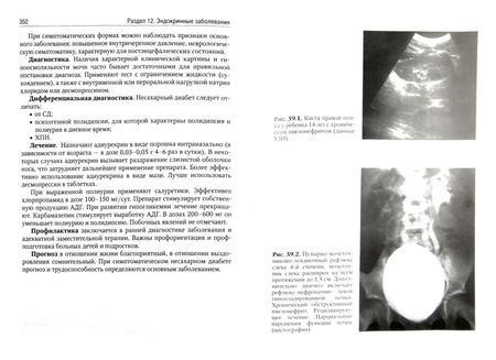 Фотография книги "Григорьев, Харитонова: Детские болезни. Учебник в 2-х томах. Том 2"