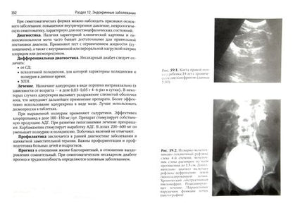 Фотография книги "Григорьев, Харитонова: Детские болезни. Учебник в 2-х томах. Том 2"