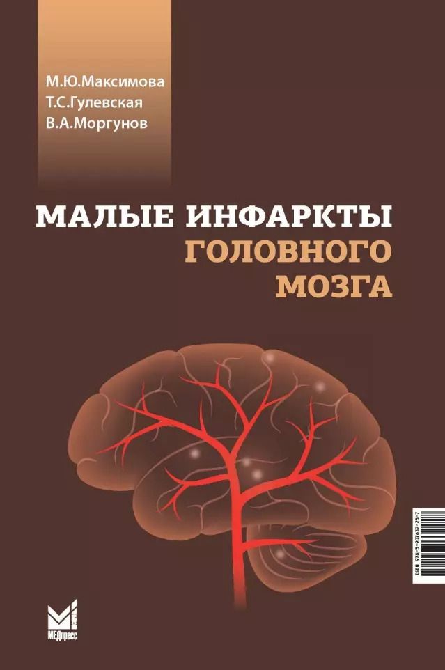 Обложка книги "Гулевская, Максимова, Моргунов: Малые инфаркты головного мозга"