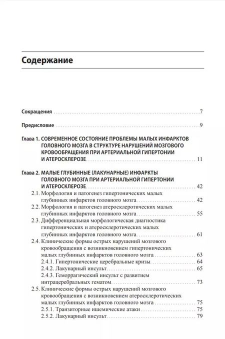 Фотография книги "Гулевская, Максимова, Моргунов: Малые инфаркты головного мозга"