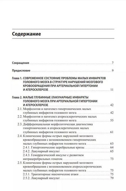 Фотография книги "Гулевская, Максимова, Моргунов: Малые инфаркты головного мозга"