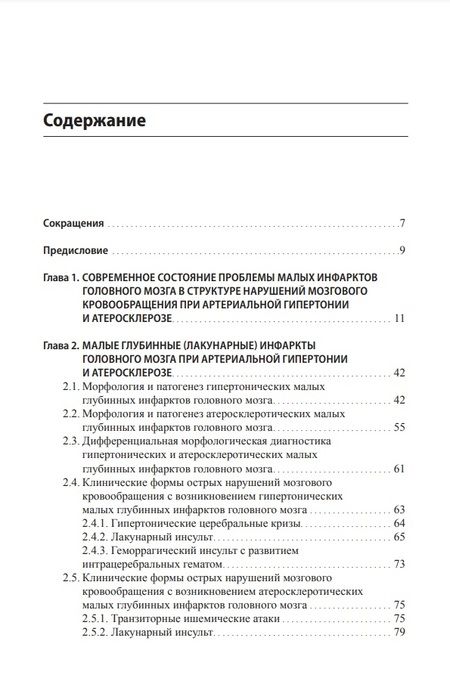 Фотография книги "Гулевская, Максимова, Моргунов: Малые инфаркты головного мозга"