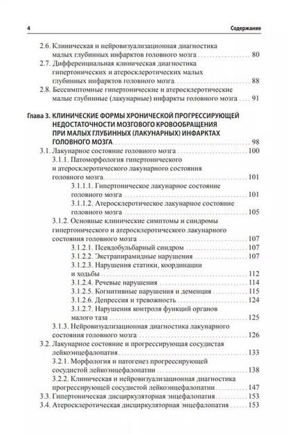 Фотография книги "Гулевская, Максимова, Моргунов: Малые инфаркты головного мозга"