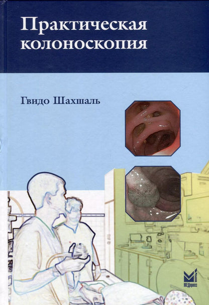 Обложка книги "Гвидо Шахшаль: Практическая колоноскопия"