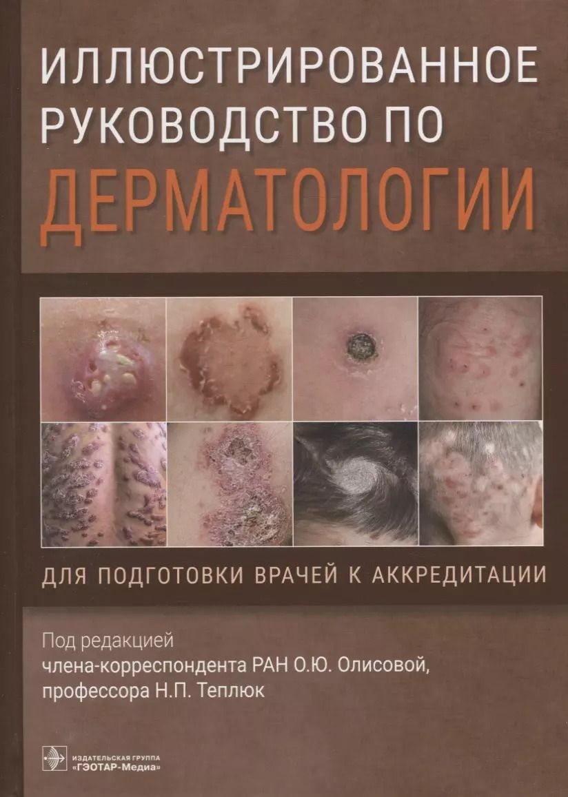 Обложка книги "Иллюстрированное руководство по дерматологии. Для подготовки врачей к аккредитации"