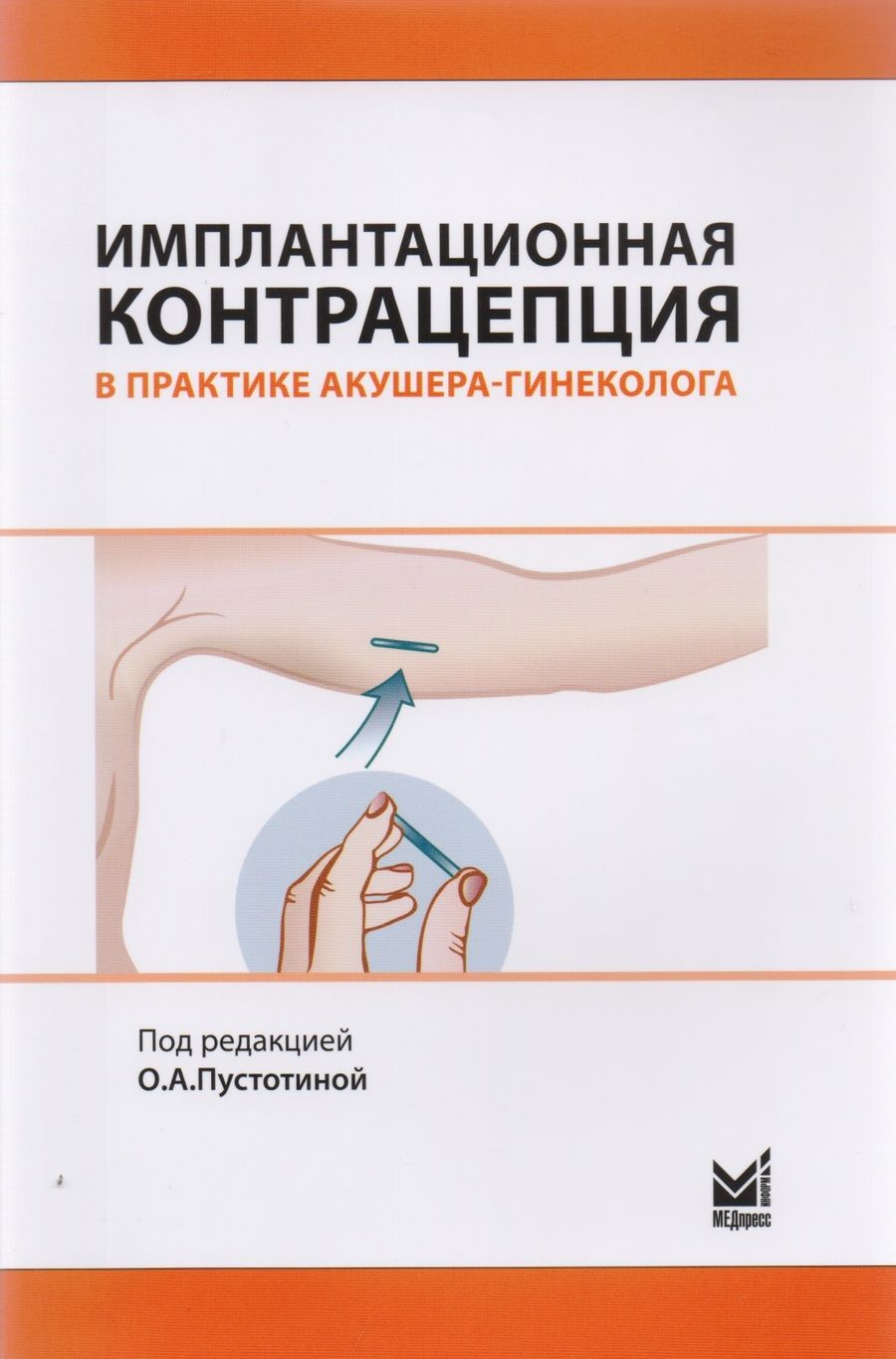 Обложка книги "Имплантационная контрацепция в практике акушера-гинеколога"