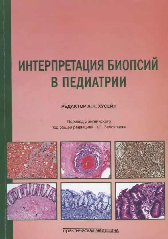 Обложка книги "Интерпретация биопсий в педиатрии"