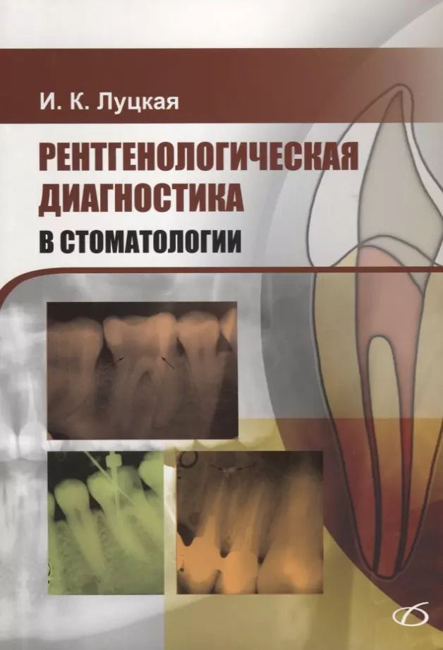 Обложка книги "Ирина Луцкая: Рентгенологическая диагностика в стоматологии"