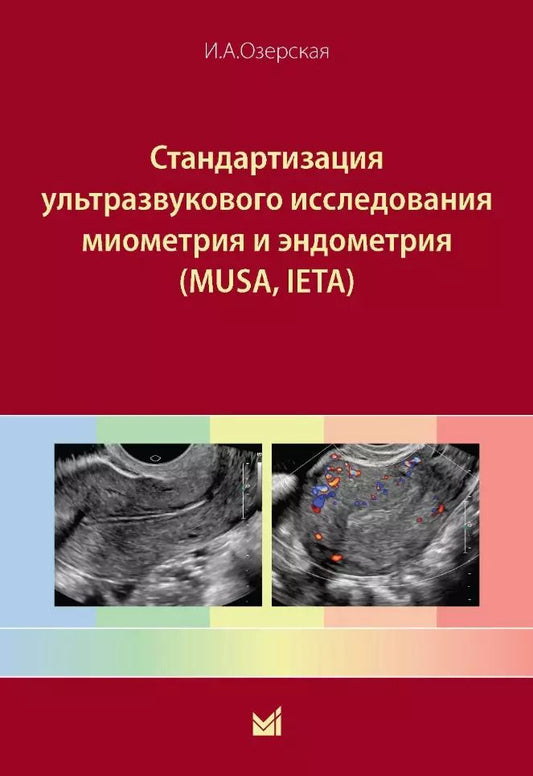Обложка книги "Ирина Озерская: Стандартизация ультразвукового исследования миометрия и эндометрия (MUSA, IETA)"