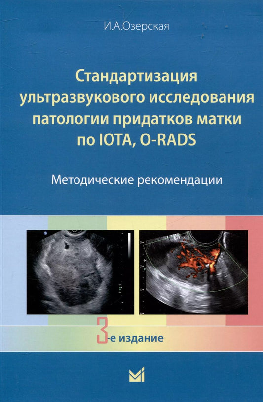 Обложка книги "Ирина Озерская: Стандартизация ультразвукового исследования патологии придатков матки по IOTA, O-RADS. Методические рекомендации"