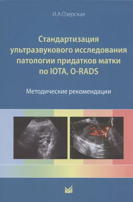 Обложка книги "Ирина Озерская: Стандартизация ультразвукового исследования патологии придатков матки по IOTA, O-RADS. Методические рекомендации"