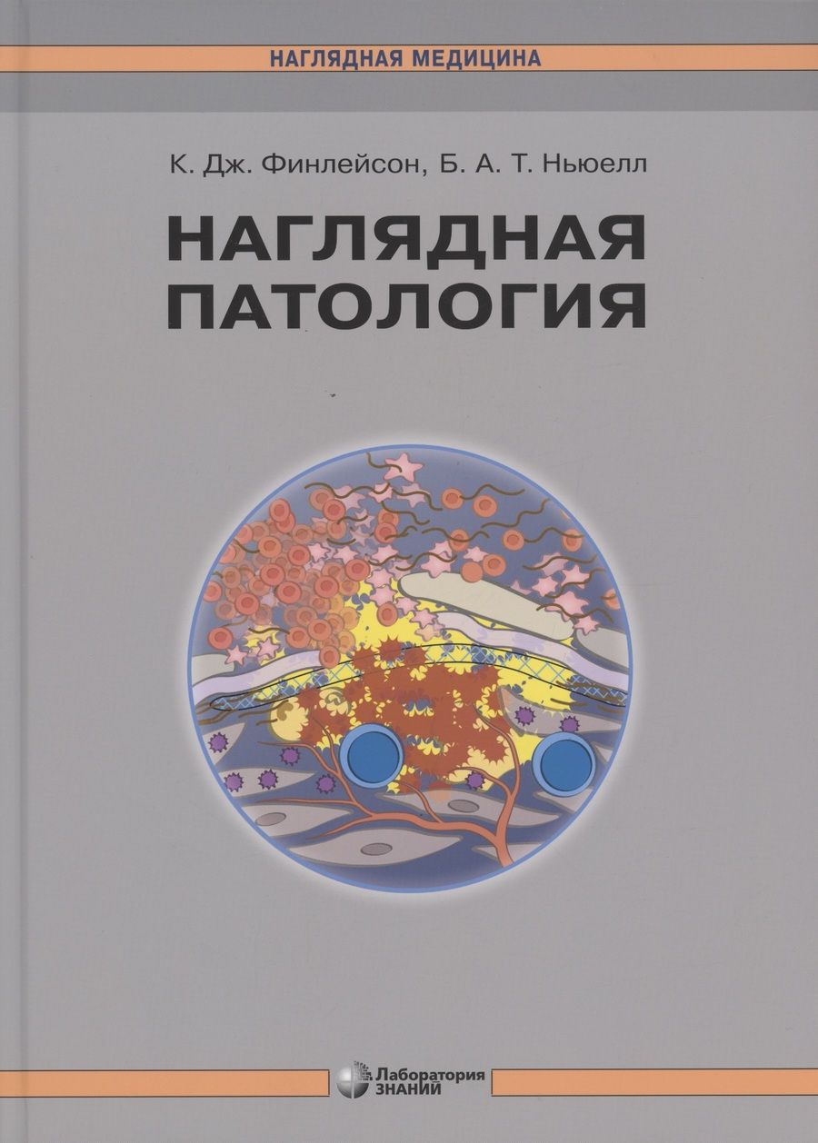 Обложка книги "К. Финлейсон: Наглядная патология"