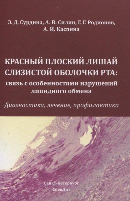 Обложка книги "Каспина, Силин, Сурдина: Красный плоский лишай слизистой оболочки рта: связь с особенностями нарушений липидного обмена"