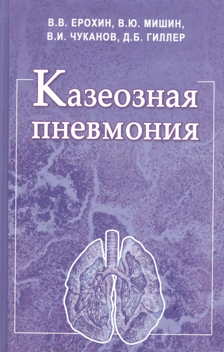 Обложка книги "Казеозная пневмония. Руководство для врачей"