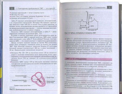 Фотография книги "Хэмптон, Эдлэм: ЭКГ в практике врача"