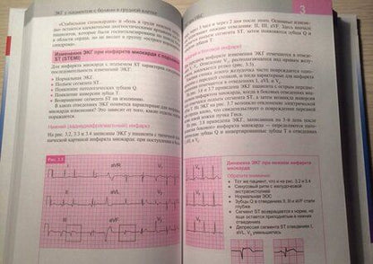 Фотография книги "Хэмптон, Эдлэм: ЭКГ в практике врача"