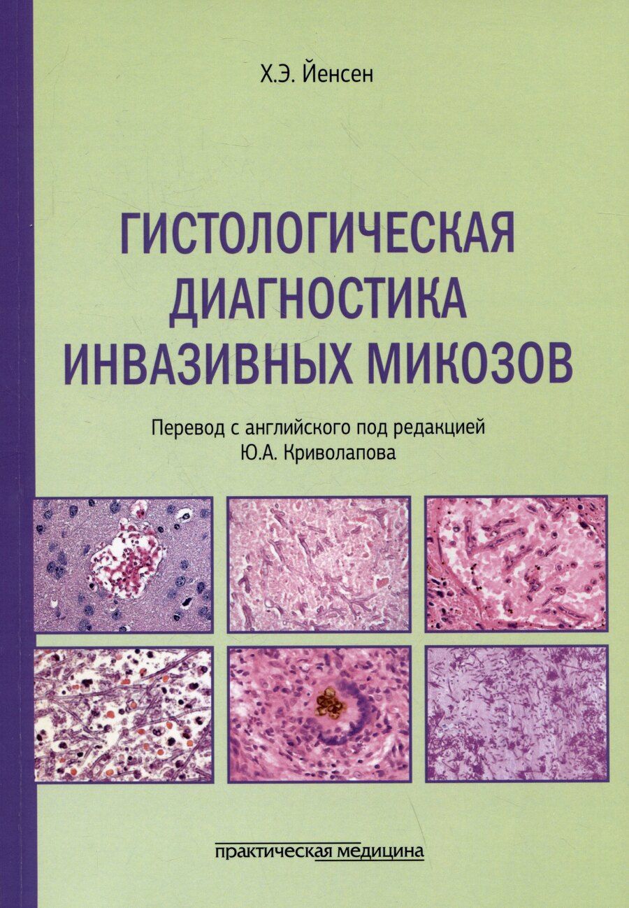 Обложка книги "Хенрик Элванг: Гистологическая диагностика инвазивных микозов"