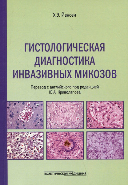 Обложка книги "Хенрик Элванг: Гистологическая диагностика инвазивных микозов"