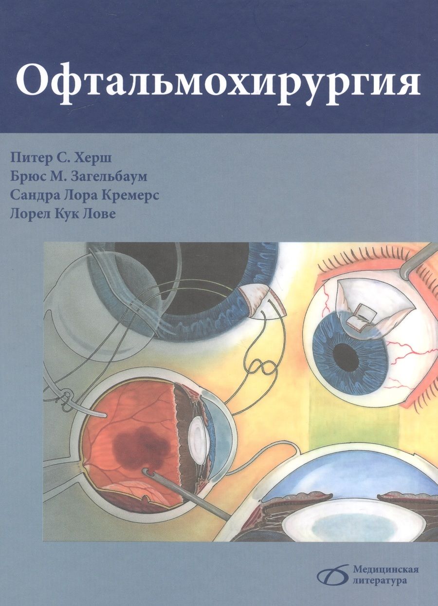 Обложка книги "Херш, Загельбаум, Кремерс: Офтальмохирургия"