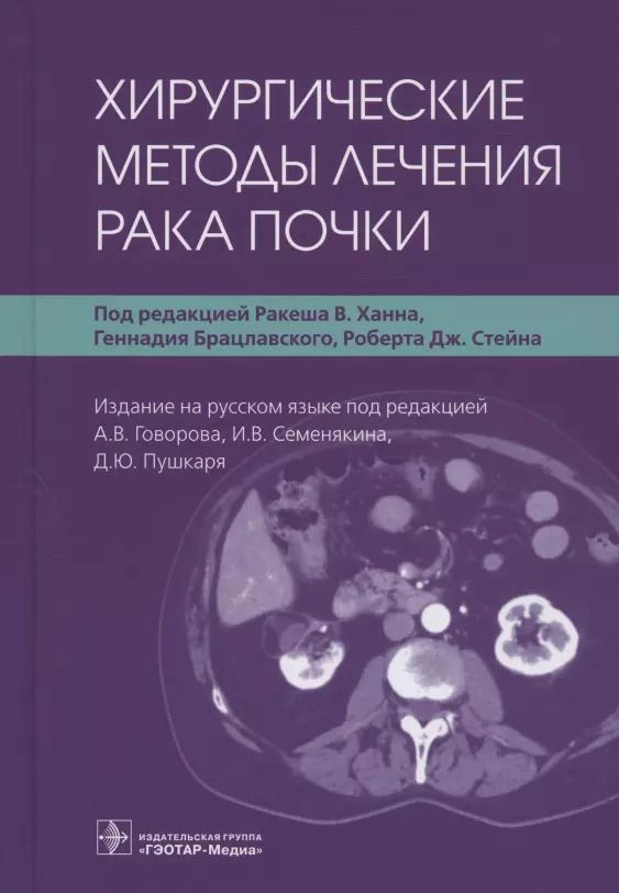 Обложка книги "Хирургические методы лечения рака почки"