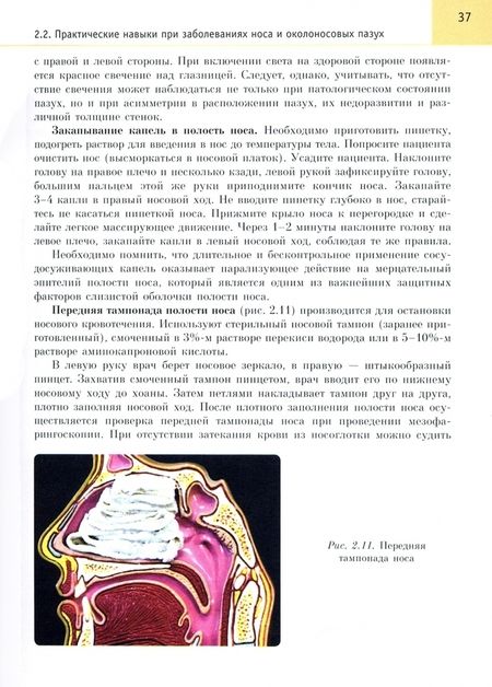 Фотография книги "Хоров, Буцель, Куницкий: Оториноларингология. Учебник"