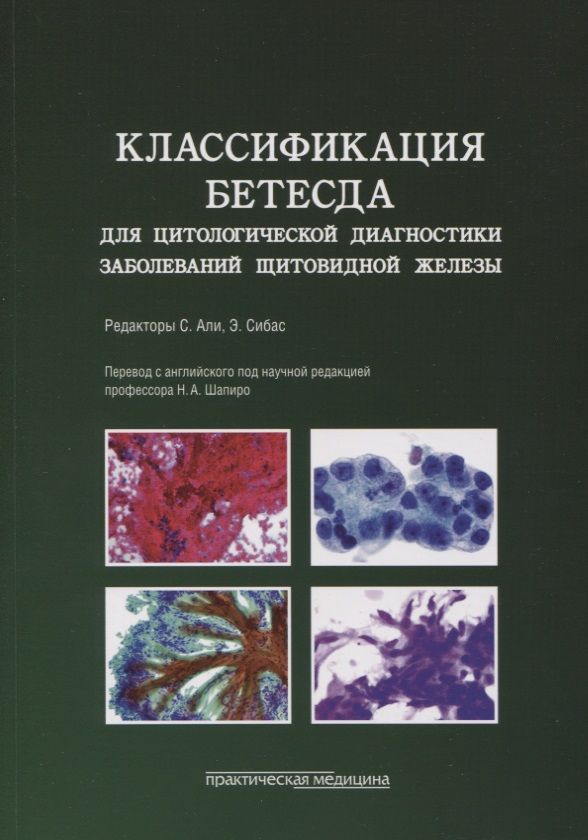 Обложка книги "Классификация Бетесда для цитологической диагностики заболеваний щитовидной железы. Терминология"