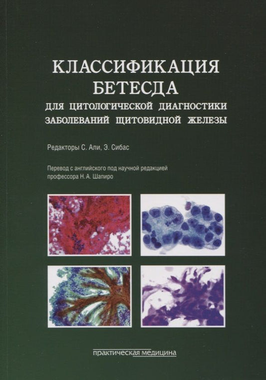 Обложка книги "Классификация Бетесда для цитологической диагностики заболеваний щитовидной железы. Терминология"