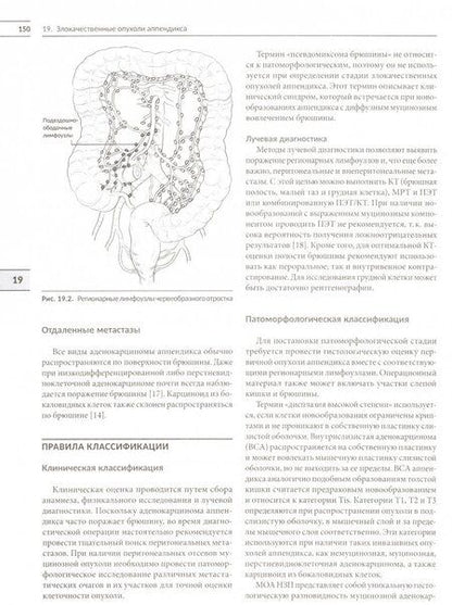 Фотография книги "Классификация опухолей TNM. Том 1. Опухоли торако-абдоминальной локализации"