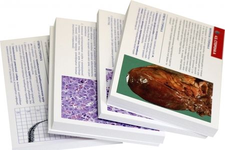 Фотография книги "Клатт, Митчелл: Патология по Роббинсу и Котрану. Дидактические карточки по патологии в форме "вопрос-ответ""