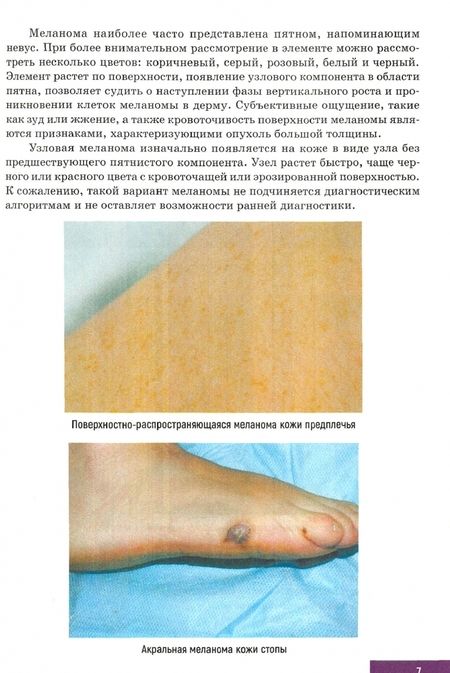 Фотография книги "Клеменова, Шливко, Гаранина: Опухоли кожи в гериатрической практике. Учебное  пособие"