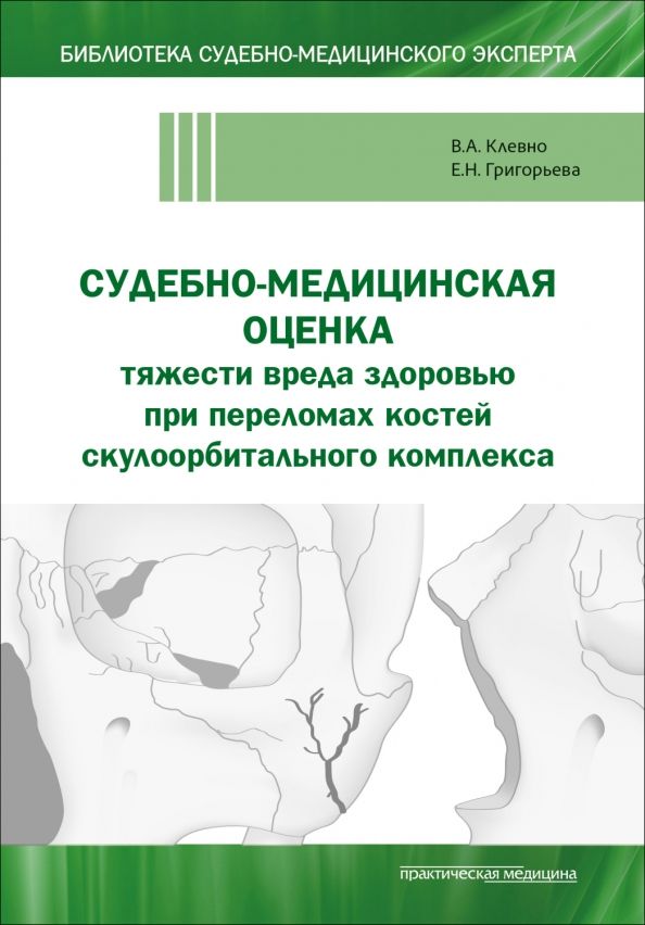 Обложка книги "Клевно, Григорьева: Судебно-медицинская оценка тяжести вреда здоровью при переломах костей скулоорбитального комплекса"