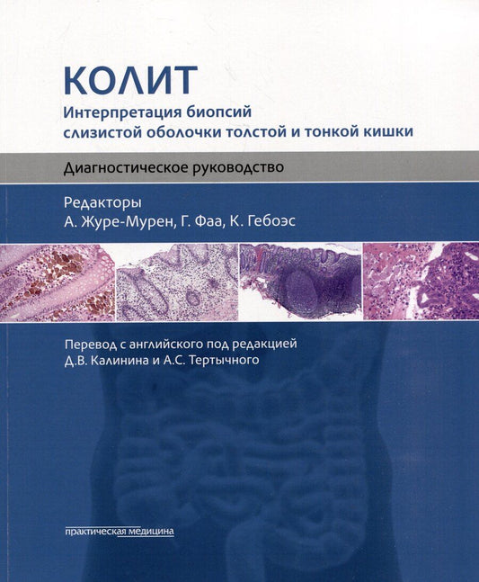 Обложка книги "Колит. Интерпретация биопсий слизистой оболочки толстой и тонкой кишки. Диагностическое руководство"