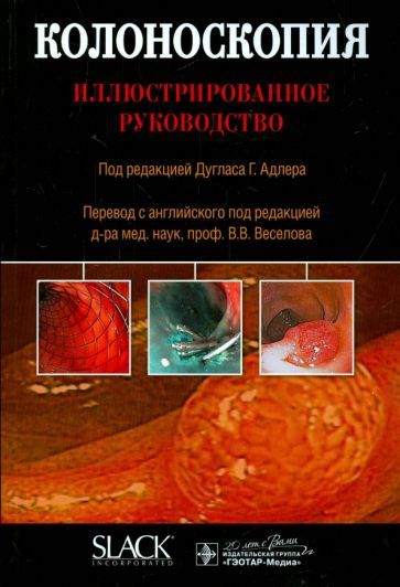 Обложка книги ": Колоноскопия. Иллюстрированное руководство"