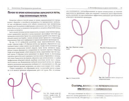 Фотография книги ": Колоноскопия. Иллюстрированное руководство"