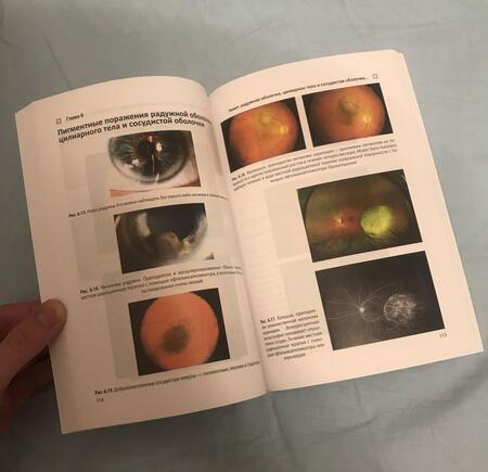 Фотография книги "Констебль, Вон, Раджа: Цветной атлас по офтальмологии"