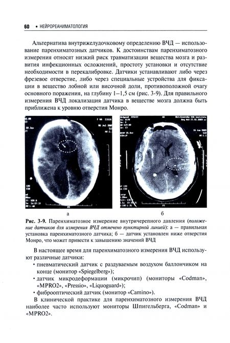 Фотография книги "Крылов, Петриков, Рамазанов: Нейрореаниматология. Практическое руководство"