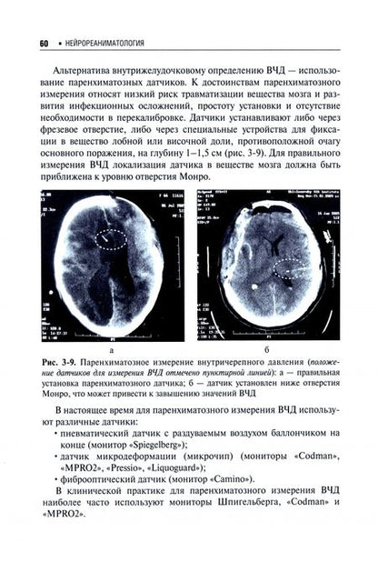 Фотография книги "Крылов, Петриков, Рамазанов: Нейрореаниматология. Практическое руководство"