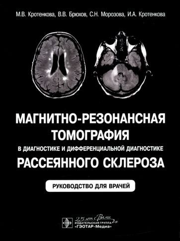 Обложка книги "Кротенкова, Брюхов, Морозова: Магнитно-резонансная томография в диагностике и дифференциальной диагностике рассеянного склероза"