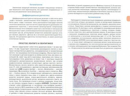 Фотография книги "Кроусон, Магро, Мим: Интерпретация биопсий кожи. Первичные нелимфоидные опухоли кожи"