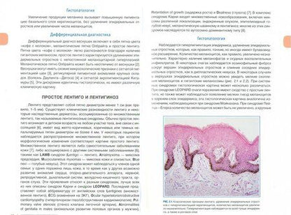 Фотография книги "Кроусон, Магро, Мим: Интерпретация биопсий кожи. Первичные нелимфоидные опухоли кожи"