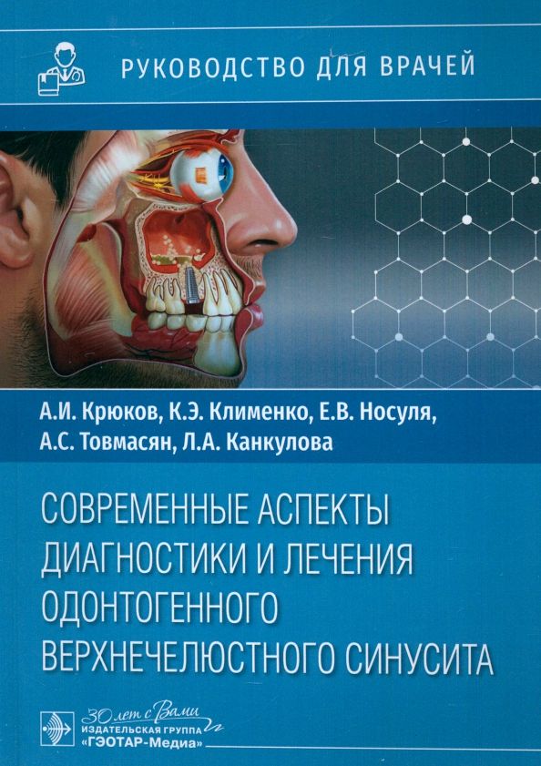 Обложка книги "Крюков, Клименко, Носуля: Современные аспекты диагностики и лечения одонтогенного верхнечелюстного синусита. Руководство"