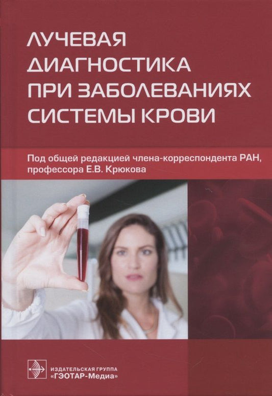 Обложка книги "Крюков, Рукавицын, Троян: Лучевая диагностика при заболеваниях системы крови"